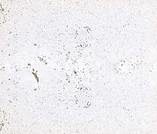 Пробковое покрытие Ibercork Настенное Classic EasyCork Лорка Пробковое покрытие Ibercork Настенное Classic EasyCork Лорка